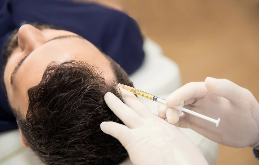 prp hair restoration injections