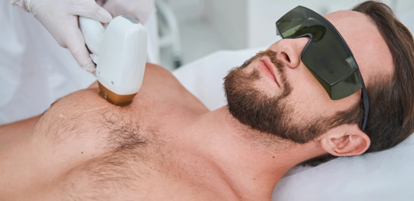 man+getting+chest+hair+removed+laser+hair+removal