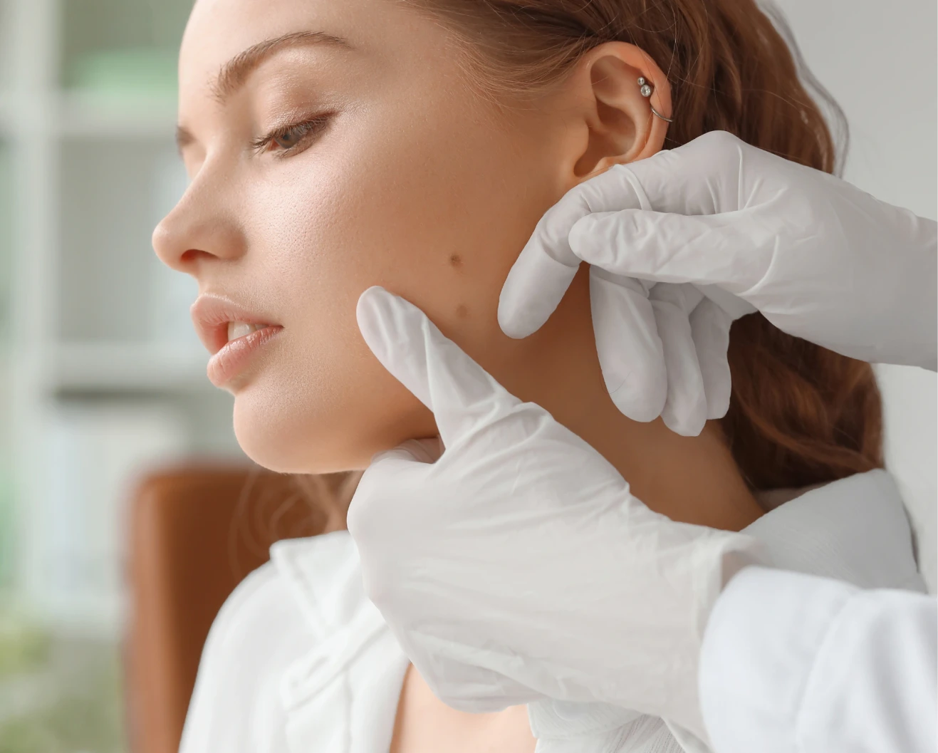 doctor assessing moles on a woman's face