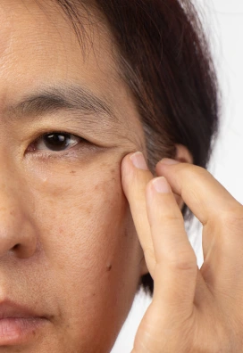 older woman with face wrinkles around eyes