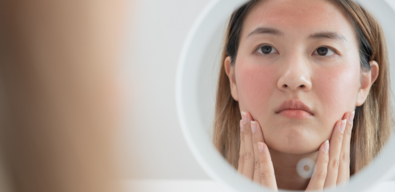 woman looking at skin redness in mirror