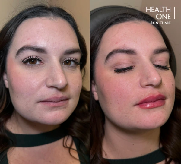 hydrate+natural+volume+lips