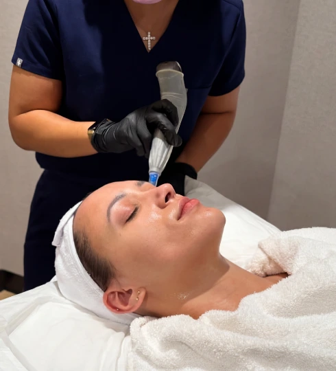 patient availing microneedling+offer+toronto