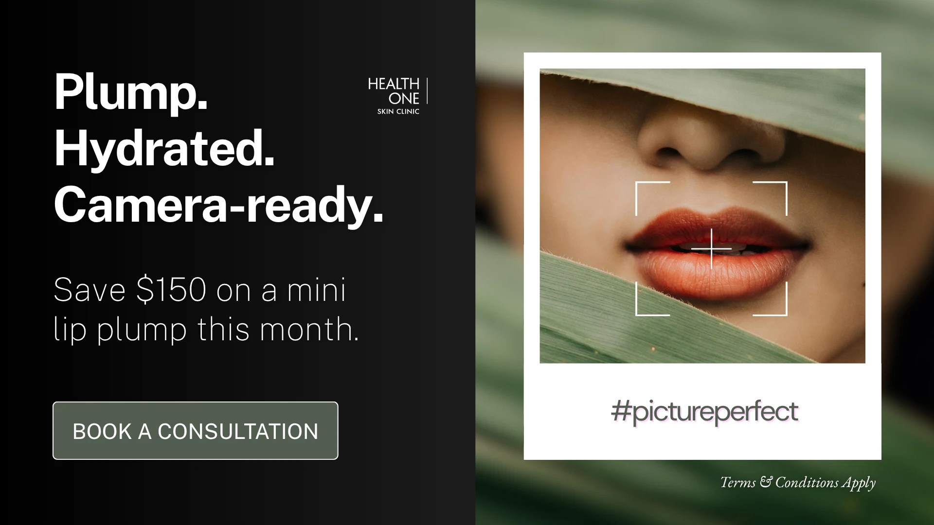 Mini lip plump for $300 at HealthOne Skin Clinic