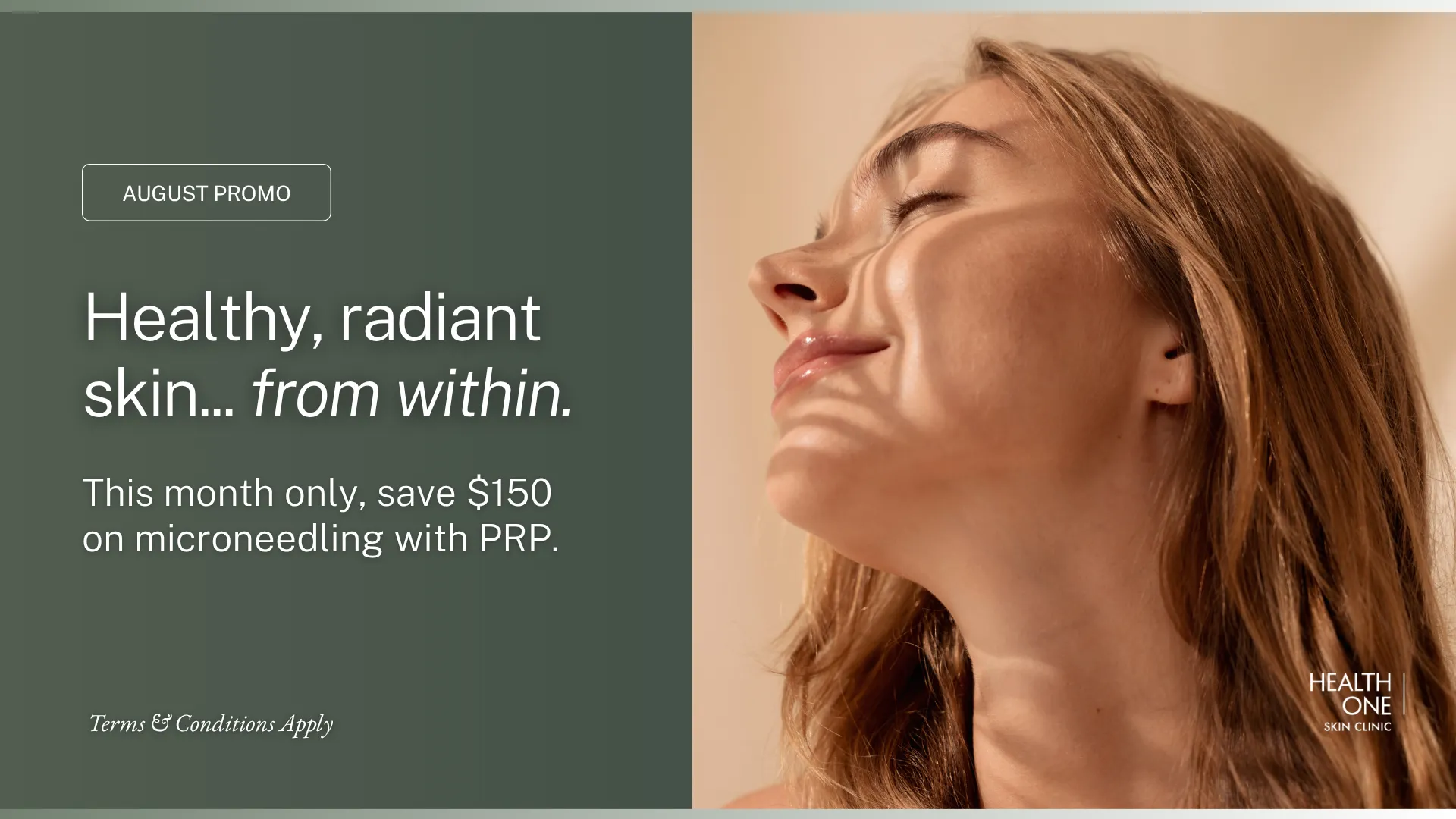 Microneedling prp $150 off